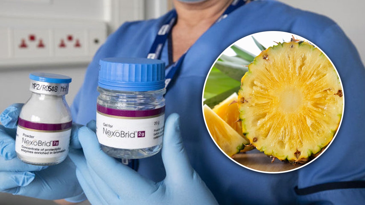 Burn treatment made from pineapples reduces the need for skin grafting surgery