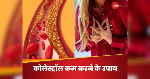 Changes these Food Diet Habits To avoid High Cholesterol Blocked For Blood Vessels | High Cholesterol ने नसों के चौड़े रास्ते को कर दिया तंग, तुरंत बदलें ये फूड हैबिट्स; मिलेगी राहत