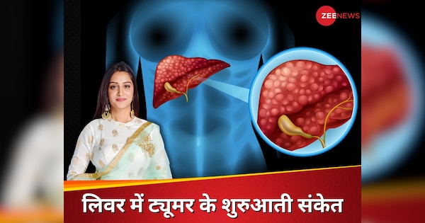 Dipika Kakkar has diagnosed with liver tumor women should not ignore these symptoms of this silent killer | दीपिका कक्कड़ के लिवर में बॉल जितना बड़ा ट्यूमर, मौत के करीब पहुंचा सकता है ये साइलेंट किलर, इन संकेतों को इग्नोर न करें महिलाएं