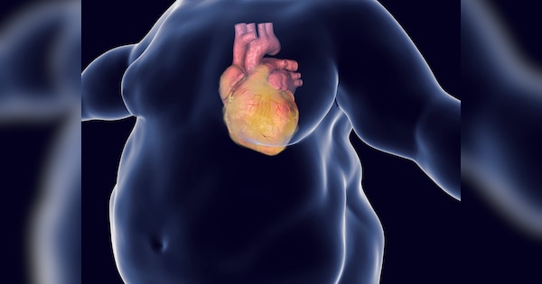 Heart also becomes fatty like liver do not ignore these symptoms otherwise you may face serious health problem | लिवर की तरह दिल भी हो जाता है फैटी, इन लक्षणों को नजरअंदाज किया तो बढ़ेगी मुसीबत!