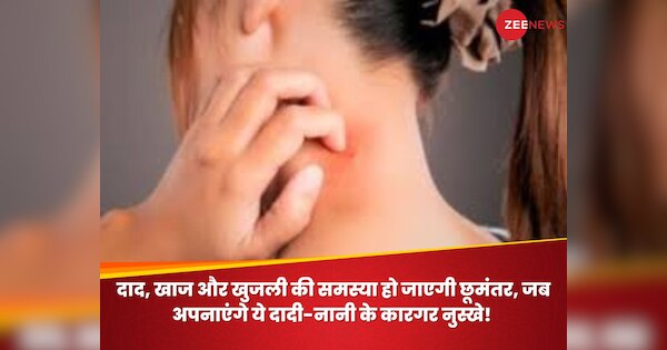 Home Remedies For Ringworm and itching daad khaj khujli ke gharelu upay