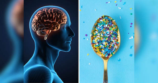 Microplastics are entering in our brain also claim latest study know its disadvantages | दिमाग में बढ़ रही प्लास्टिक की परत! रिसर्च में हुआ चौंकाने वाला खुलासा, 50% बढ़ा माइक्रोप्लास्टिक