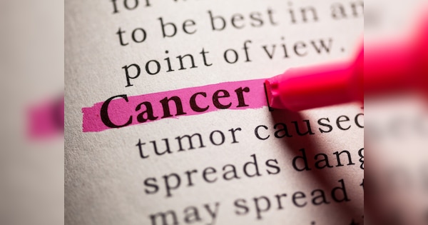 Our country need a central cancer data system to save millions of lives from cancer says expert | अगर कैंसर से बचाना है लाखों जानें, तो देश को चाहिए सेंट्रल कैंसर डेटा सिस्टम; डॉक्टरों ने बताई वजह!