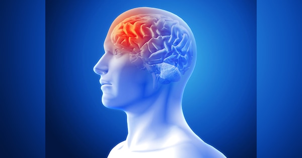 Research in Sydney Australia discovers brain swelling in long Covid chronic fatigue syndrome patients | इस रिसर्च में लॉन्ग कोविड और क्रोनिक फटीग के मरीज में ब्रेन स्वेलिंग का पता चला