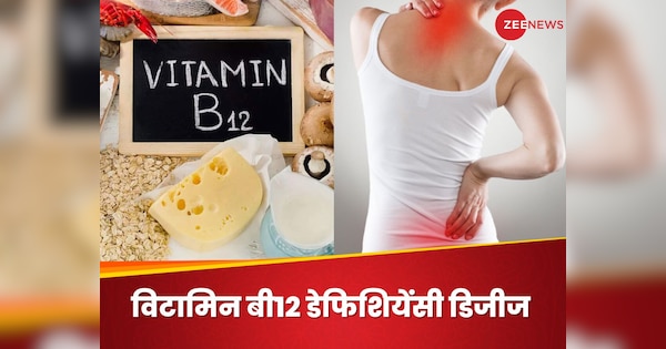 Vitamin B12 Deficiency Disease Name Anemia Low Blood And Energy In the Body | Vitamin B12: खून का कतरा-कतरा चूस लेगी विटामिन बी12 की कमी, टूट जाएगा शरीर!