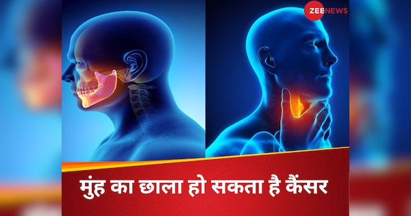 head and neck cancer increasing in youth these habits are taking them closer to death | हेड और नेक कैंसर का नया टारगेट युवा, ये आदतें ले जा रही मौत के करीब