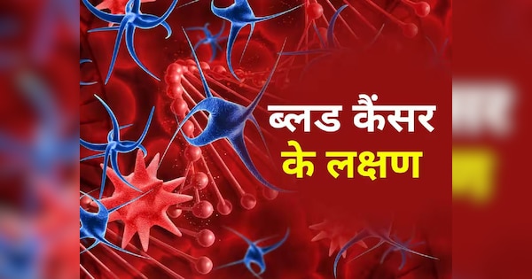khoon ke cancer ke lakshan | warning signs of blood cancer | What is the first stage of blood cancer | Blood cancer symptoms and signs | ब्लड कैंसर का पहला स्टेज क्या है | ब्लड कैंसर का इलाज संभव है या नहीं | ब्लड कैंसर क्यों होता है | ब्लड कैंसर का इलाज कहां पर होता है